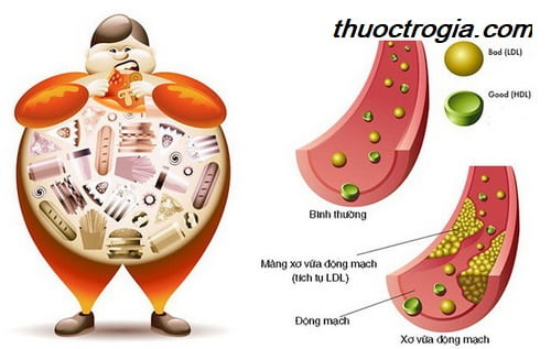 bi-quyet-kiem-soat-cholesterol-trong-mau-1